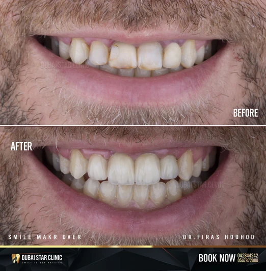 b72587_64788528e0a04f1da18ae4bf7e9bf94a~mv2